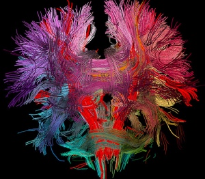 brain connections